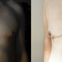 self-adhesive nipples (ftm)