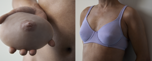 triangle breast prosthesis